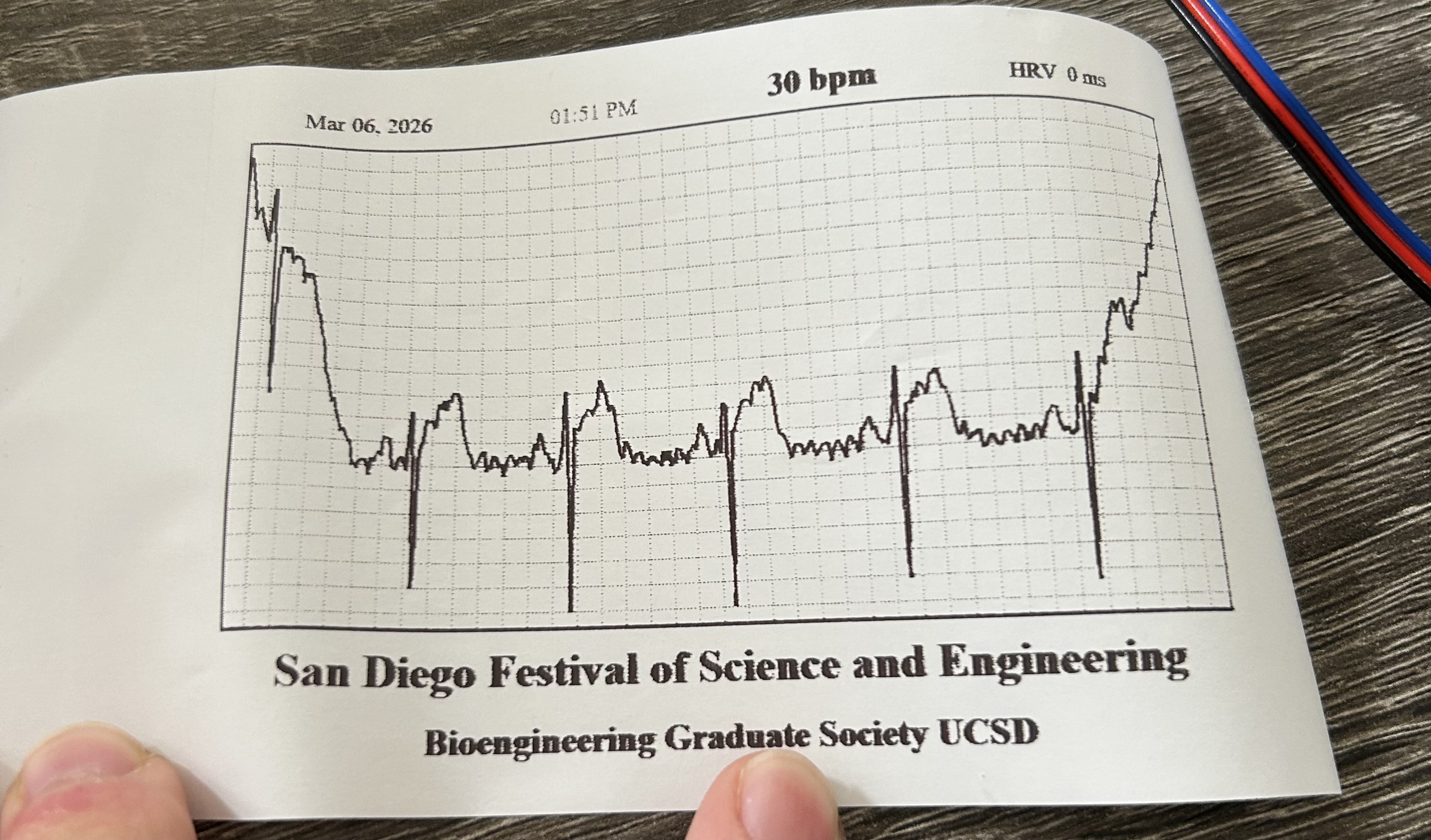 Printed ECG results (but an early attempt, hence the weird signal)